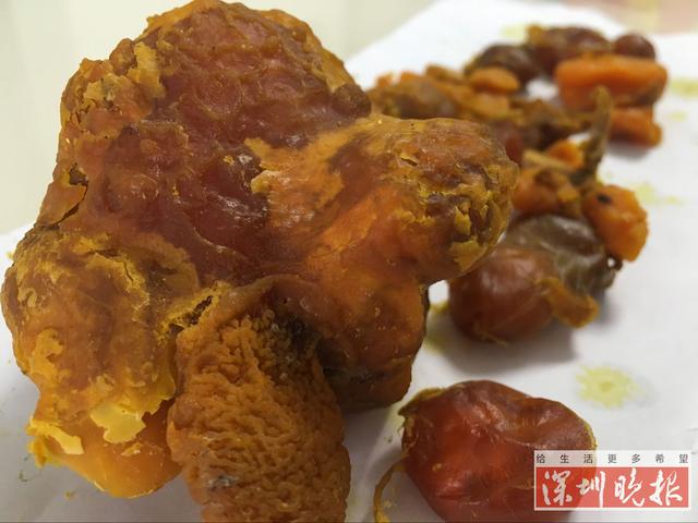 ��������ɱ�����ּ�����������˾��ֵ������(ͼ)