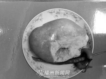 ͼƬ��ʯը��